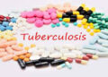 Tuberculosis in Africa